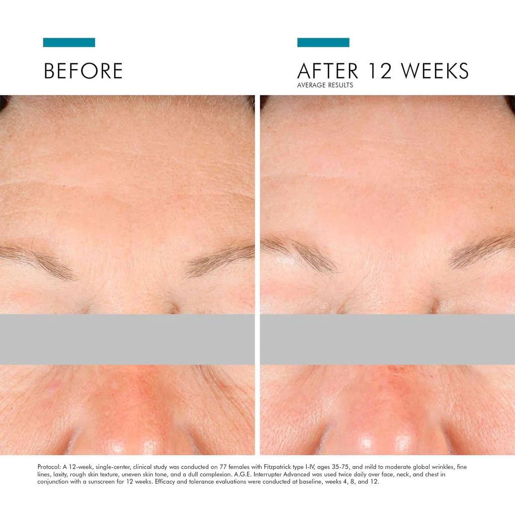 商品SkinCeuticals|A.G.E. Interrupter Advanced,价格¥1487,第4张图片详细描述