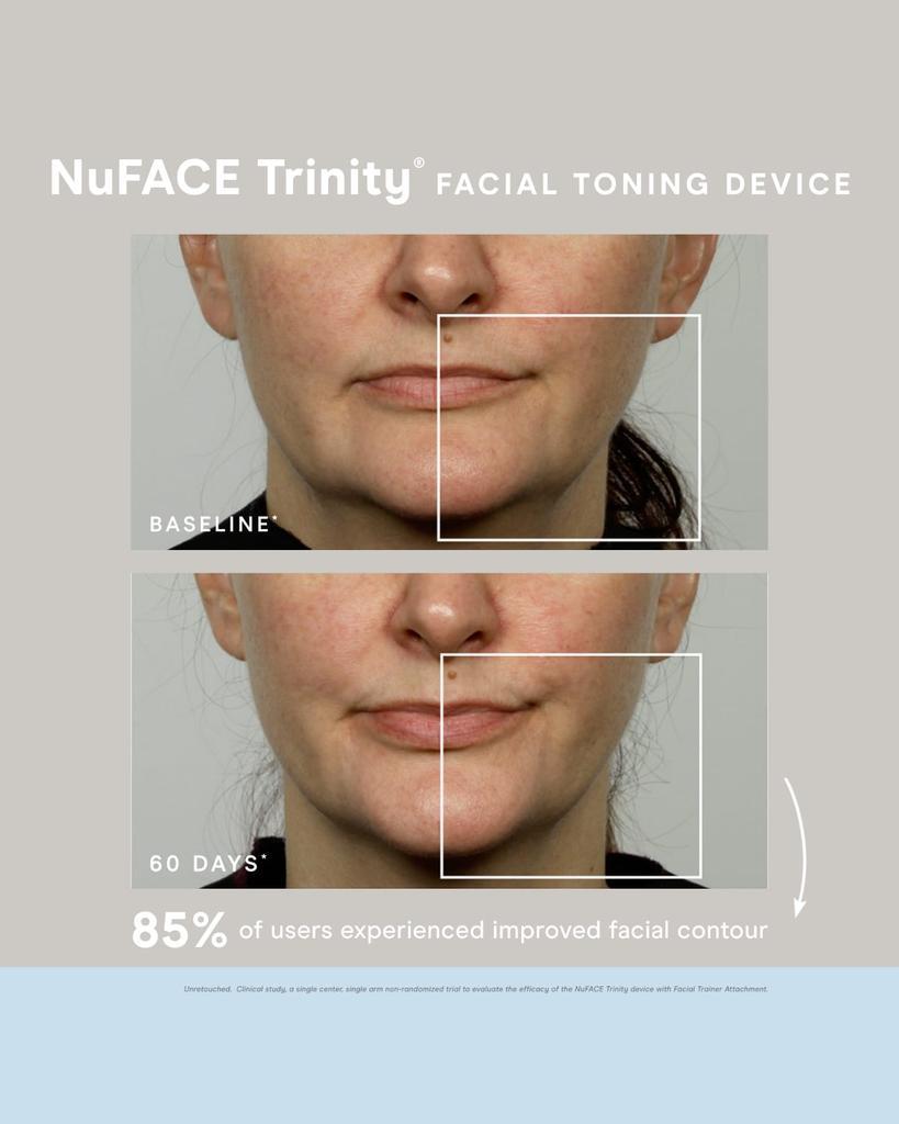 商品NuFace|NuFACE Trinity,价格¥2496,第5张图片详细描述