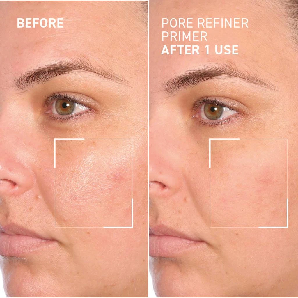商品Dr. Brandt Skincare|PORE REFINER PRIMER,价格¥363,第3张图片详细描述