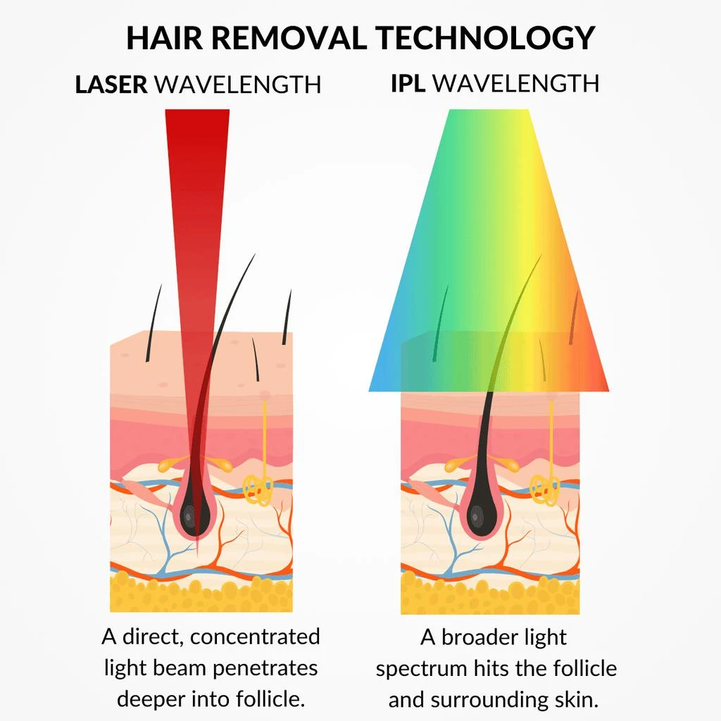 商品CurrentBody Skin|CurrentBody Skin Laser Hair Removal Device.Hongmall,价格¥5702,第3张图片详细描述