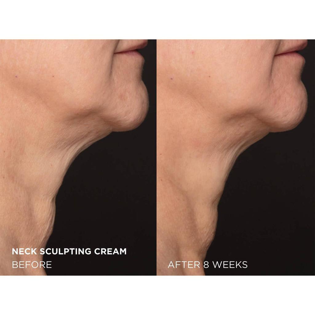 商品Dr. Brandt Skincare|Dr. Brandt Needles No More Neck Sculpting Cream 50g,价格¥708,第6张图片详细描述
