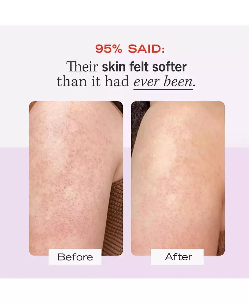 商品First Aid Beauty|KP Bump Eraser Body Scrub with 10% AHA – Body Exfoliant for Keratosis Pilaris, 8.0 oz.,价格¥89,第4张图片详细描述