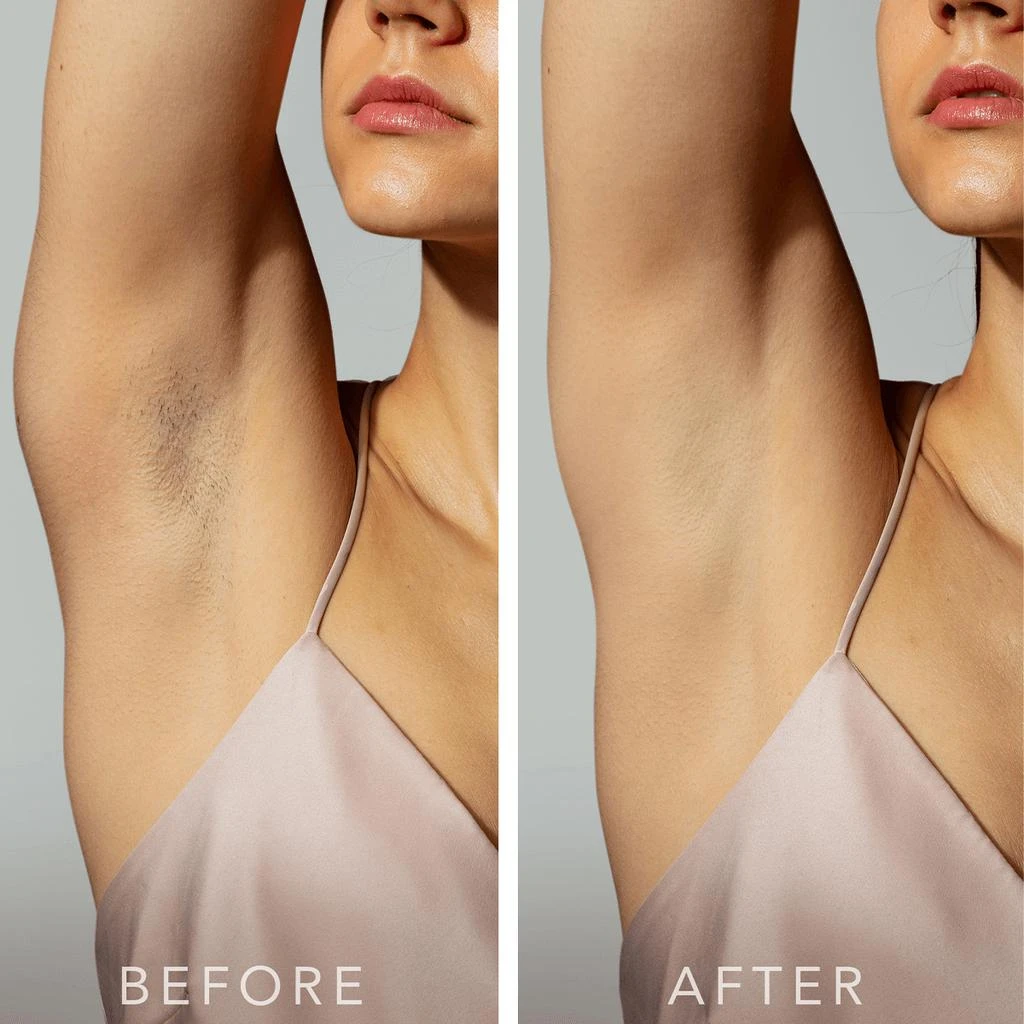 商品Foreo|FOREO PEACH 2 Advanced IPL Hair Removal Device,价格¥2096,第3张图片详细描述