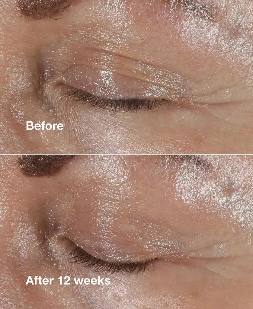 商品Clinique|Smart Clinical Repair Wrinkle Correcting Eye Cream, 0.5oz,价格¥486,第4张图片详细描述