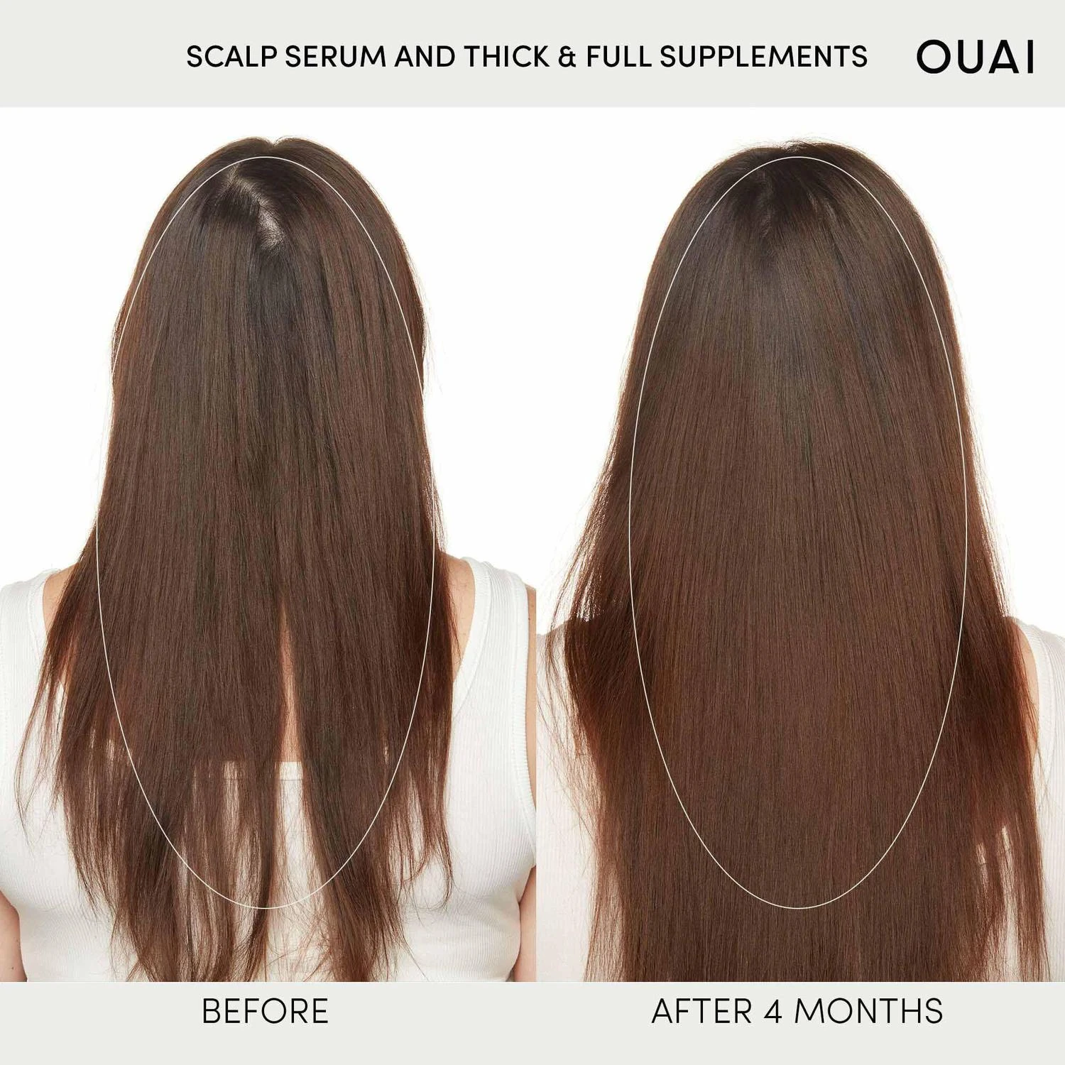 商品OUAI|Hydrating Scalp Serum & Supplements Set for Healthy, Fuller Looking Hair,价格¥585,第1张图片详细描述