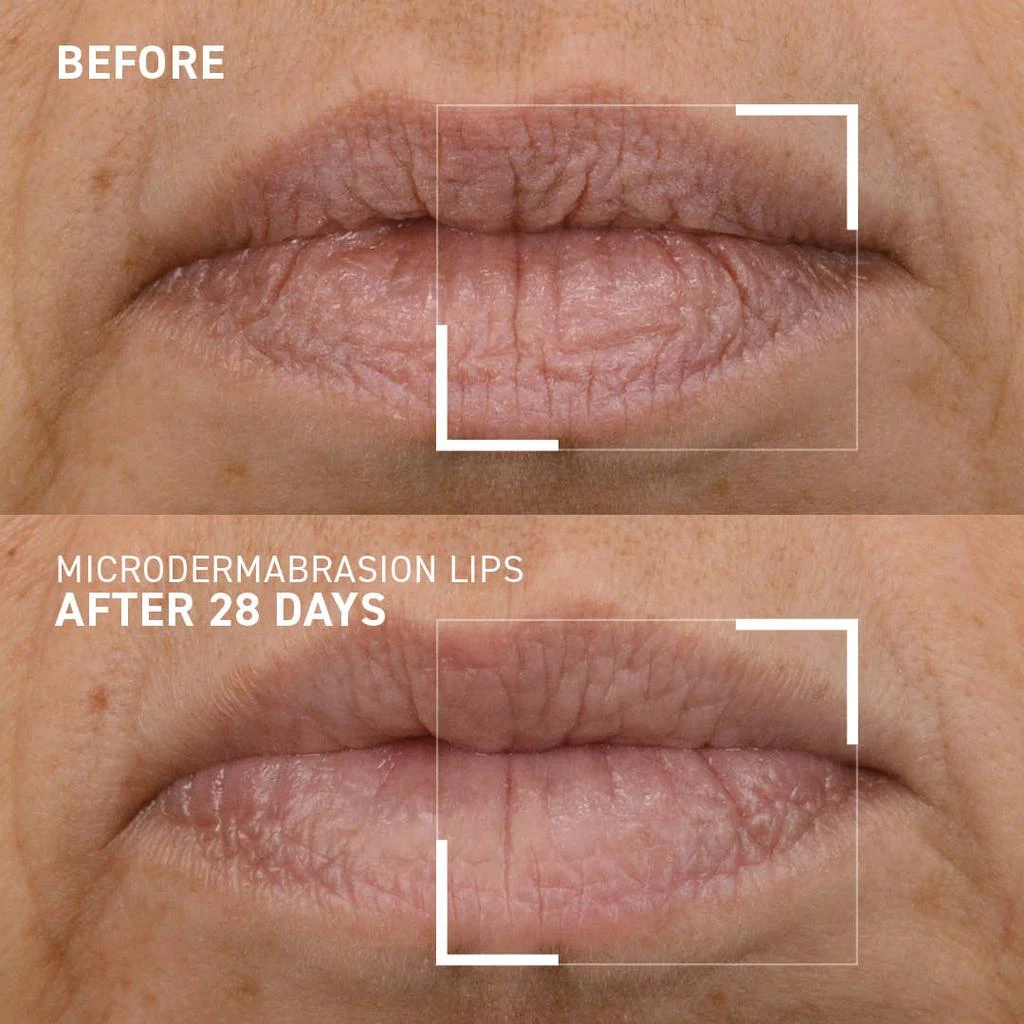 商品Dr. Brandt Skincare|SMOOTHING LIP EXFOLIATOR,价格¥227,第4张图片详细描述