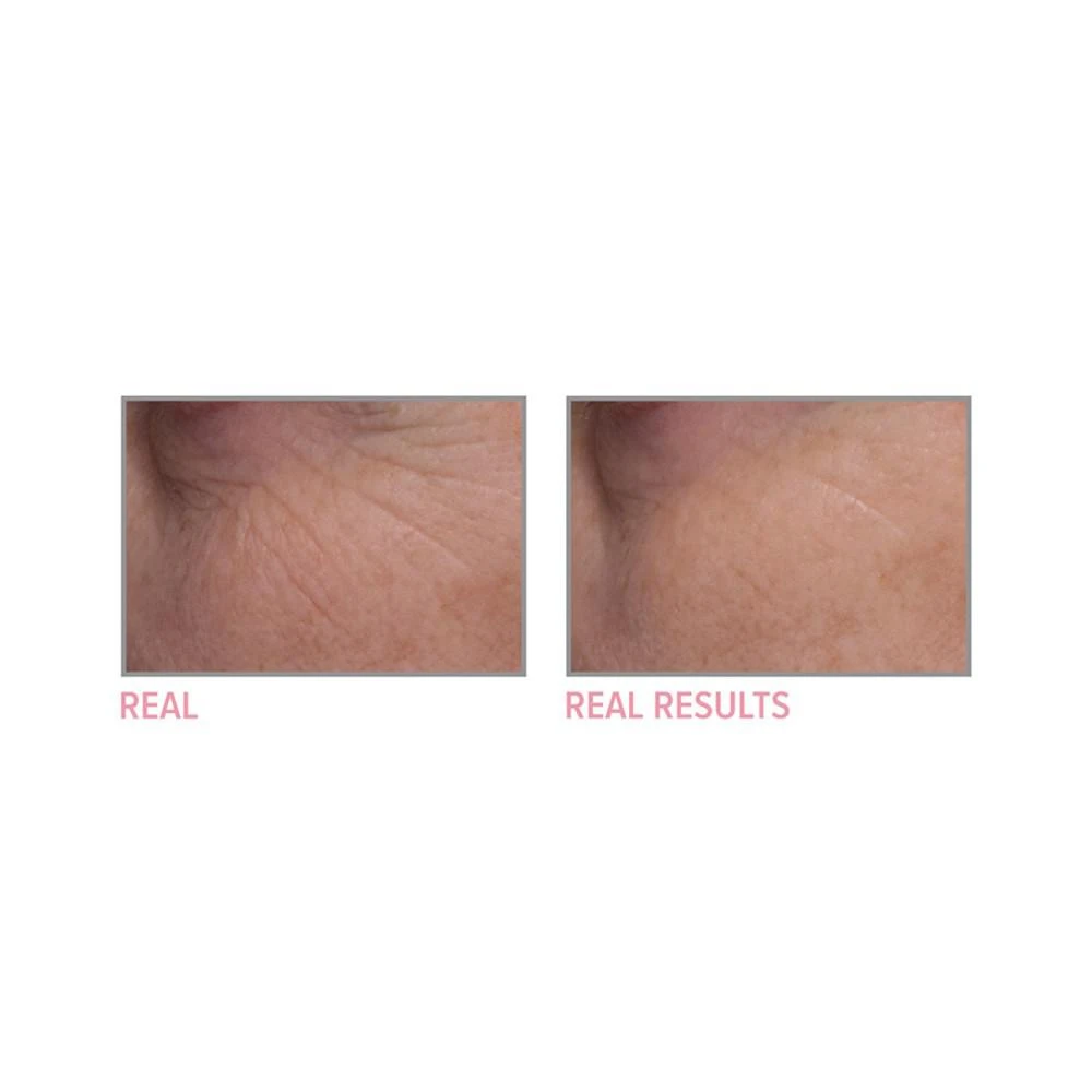 商品IT Cosmetics|Bye Bye Lines Serum, 1 oz,价格¥430,第2张图片详细描述