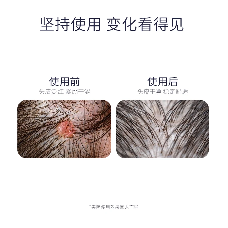 PHYTO发朵清透舒缓洗发水250ml 舒敏镇静头皮 商品