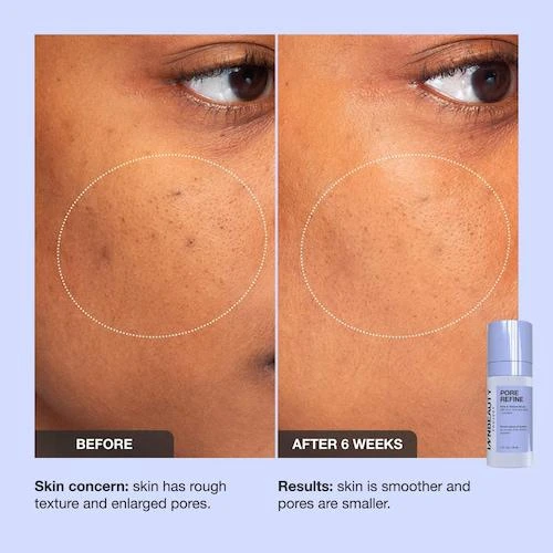 Pore Refine Pore Shrinking & Texture Smoothing Serum 商品