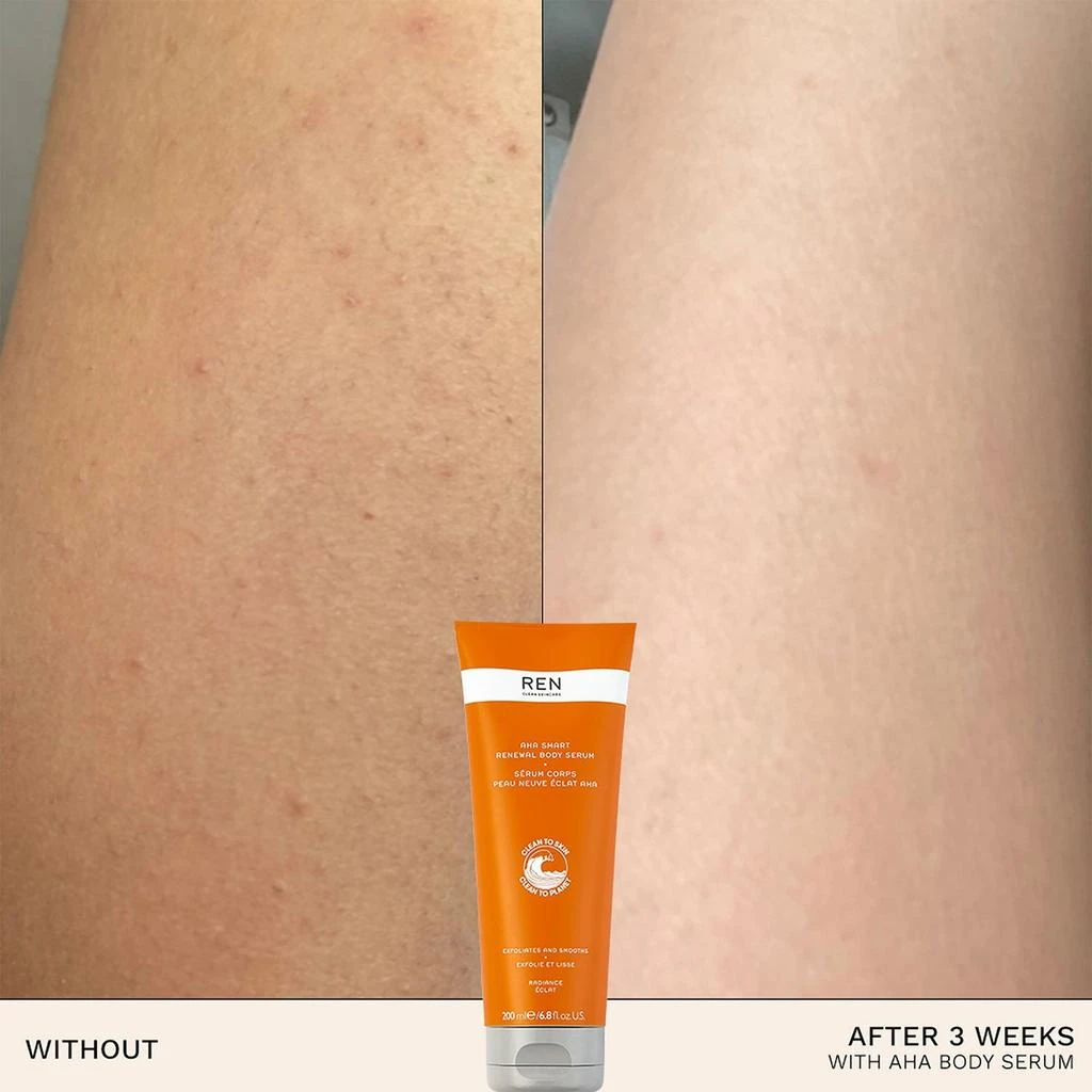 商品REN Clean Skincare|REN Clean Skincare AHA Smart Renewal Body Serum,价格¥383,第2张图片详细描述