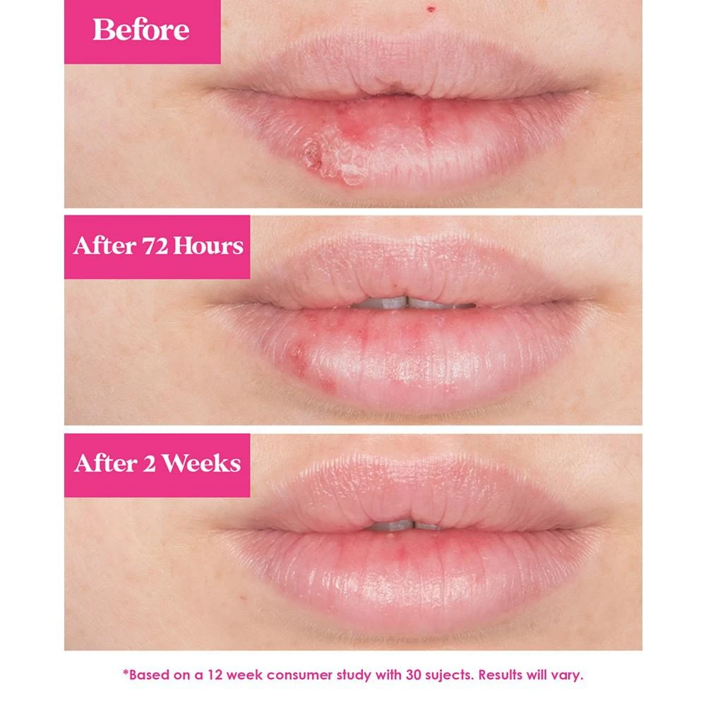 GrandePOUT Plumping Lip Mask - Peach 商品