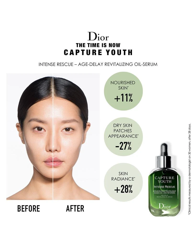 商品Dior|Capture Youth Intense Rescue Oil Serum, 1 oz,价格¥850,第3张图片详细描述