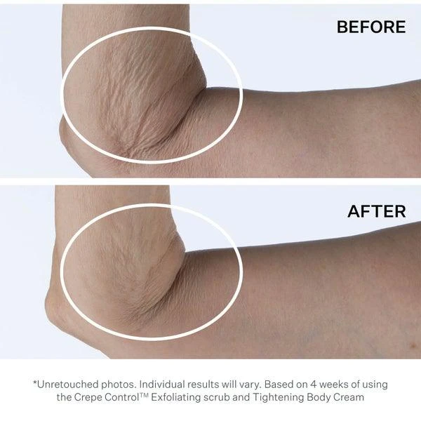 商品StriVectin|StriVectin Crepe Control Exfoliating Body Scrub 5 fl. oz,价格¥283,第5张图片详细描述
