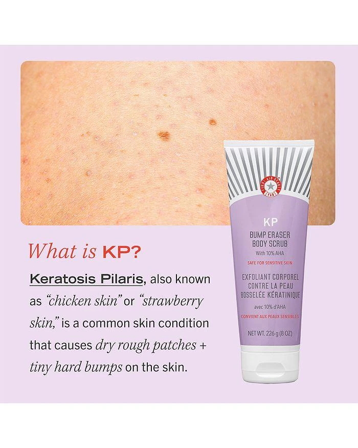 商品First Aid Beauty|KP Bump Eraser Body Scrub with 10% AHA - Body Exfoliant for Keratosis Pilaris,价格¥90,第2张图片详细描述