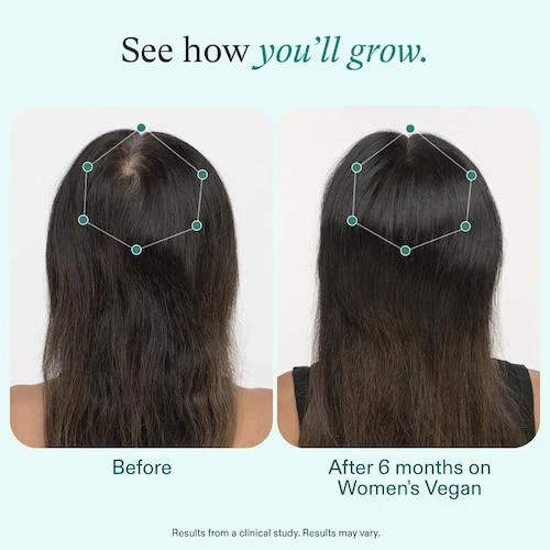 商品Nutrafol|WOMEN’S VEGAN Clinically Proven Hair Growth Supplement for Thinning,价格¥688,第2张图片详细描述