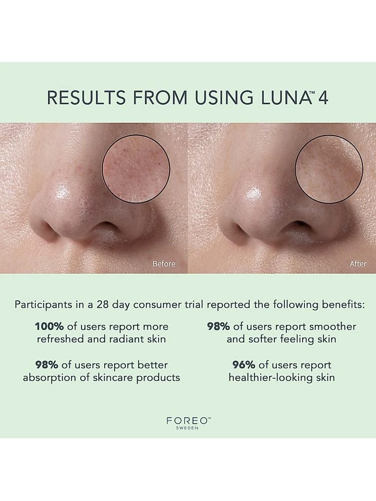Luna 4 Facial Cleansing & Firming Massage Device For Combination Skin 商品