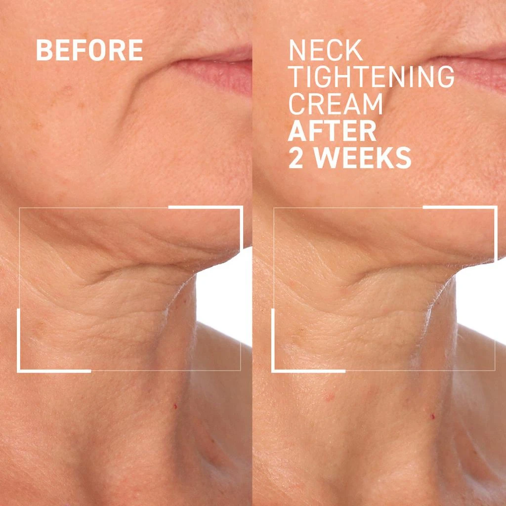 商品Dr. Brandt Skincare|NECK TIGHTENING CREAM + GUA SHA,价格¥672,第2张图片详细描述