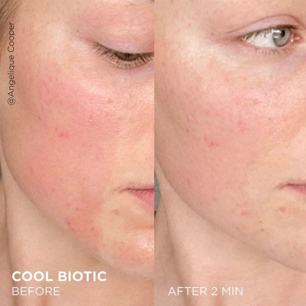 商品Dr. Brandt Skincare|Dr. Brandt Cool Biotic Prebiotic Redness Relief Cream 50g,价格¥410,第5张图片详细描述