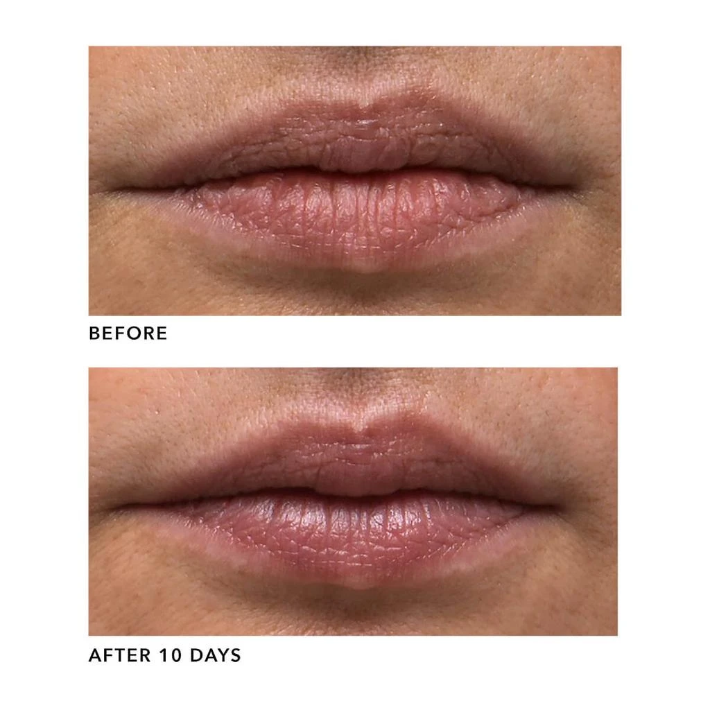 GENIUS Liquid Collagen® Lip 商品