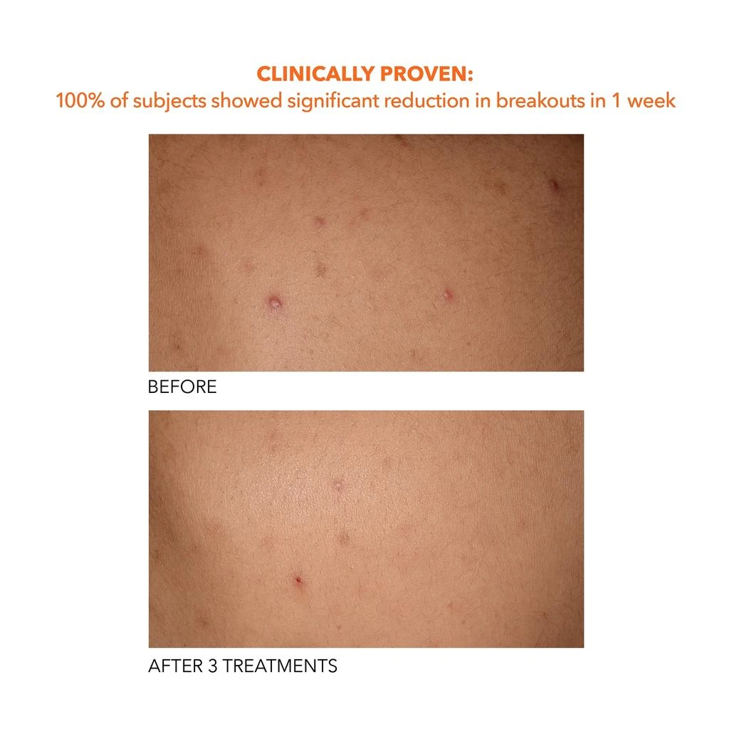Dr Dennis Gross Alpha Beta Universal Daily Peel 商品