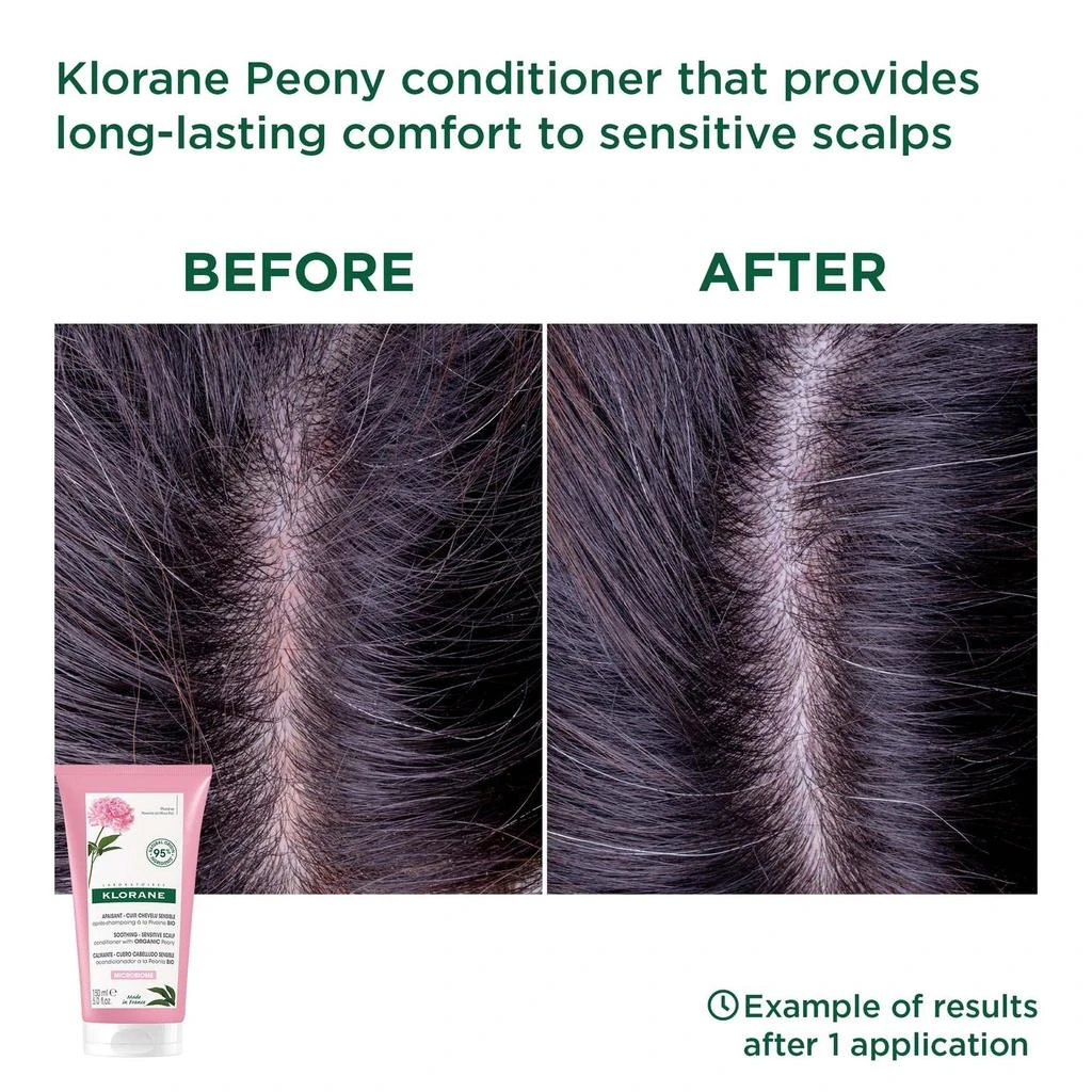 商品KLORANE|KLORANE Soothing Conditioner with Organic Peony for Sensitive Scalps 150ml,价格¥201,第2张图片详细描述