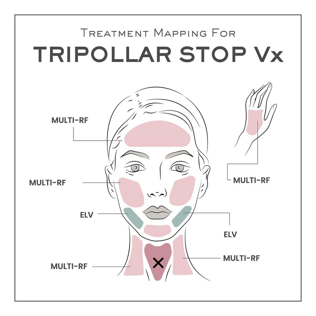 TriPollar STOP Vx 商品