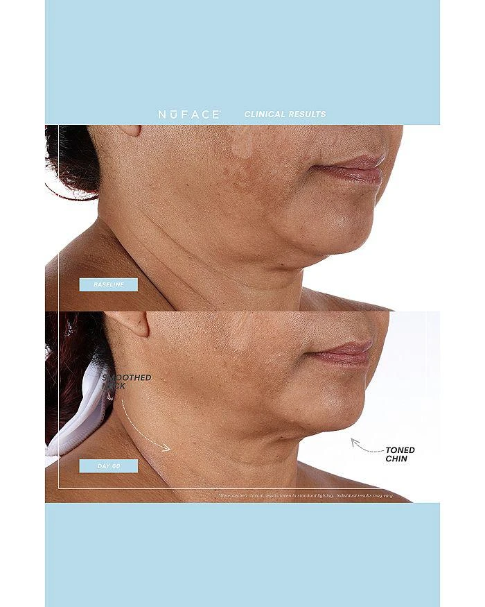 Mini+ Facial Toning Device & Primer - Purple 商品
