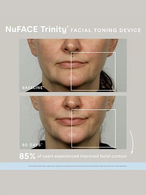 商品NuFace|Trinity Microcurrent 4-Piece Device & Skin Care Set,价格¥2535,第5张图片详细描述