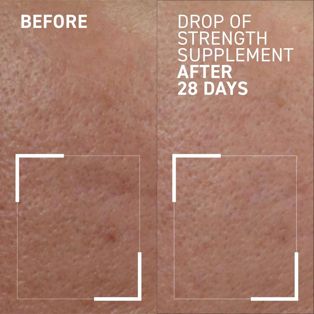 商品Dr. Brandt Skincare|Immune Protect Daily Immune Support Dietary Supplement,价格¥415,第3张图片详细描述