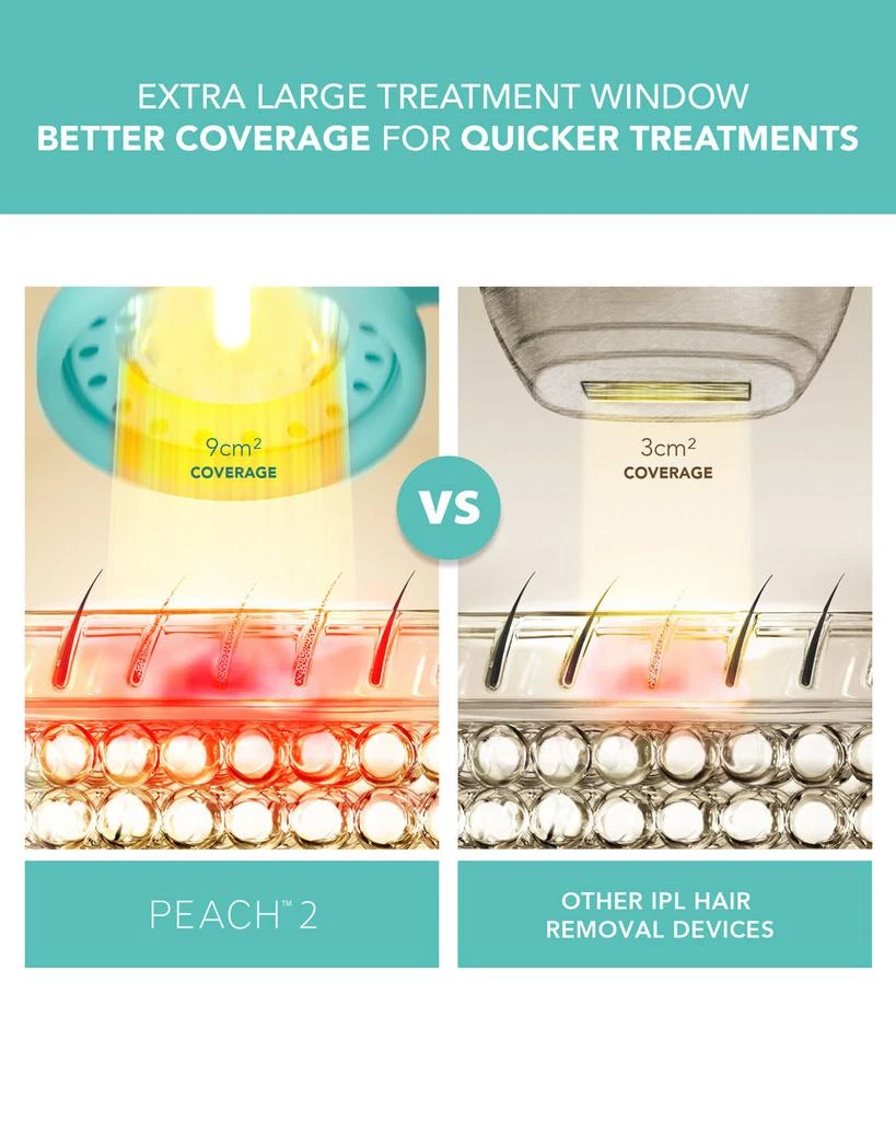 Peach 2 IPL Hair Removal Device 商品