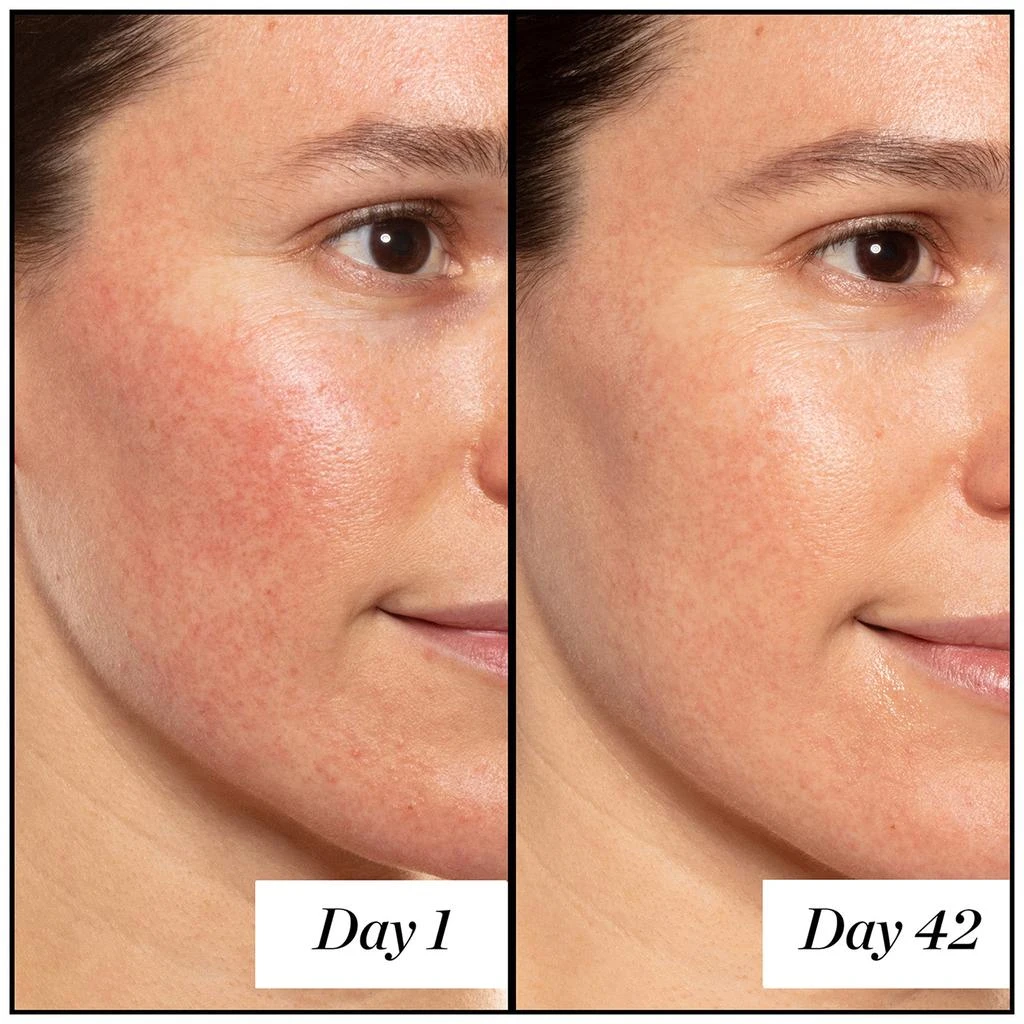 商品Sunday Riley|Sunday Riley A+ High-Dose Retinoid Serum 1.7 oz,价格¥700,第4张图片详细描述