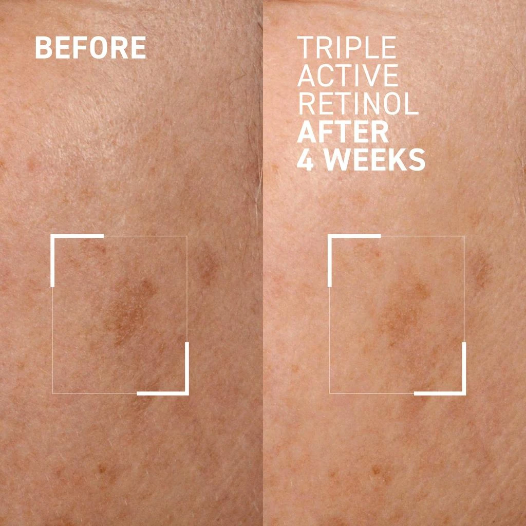 商品Dr. Brandt Skincare|TRIPLE ACTIVE RETINOL,价格¥566,第3张图片详细描述