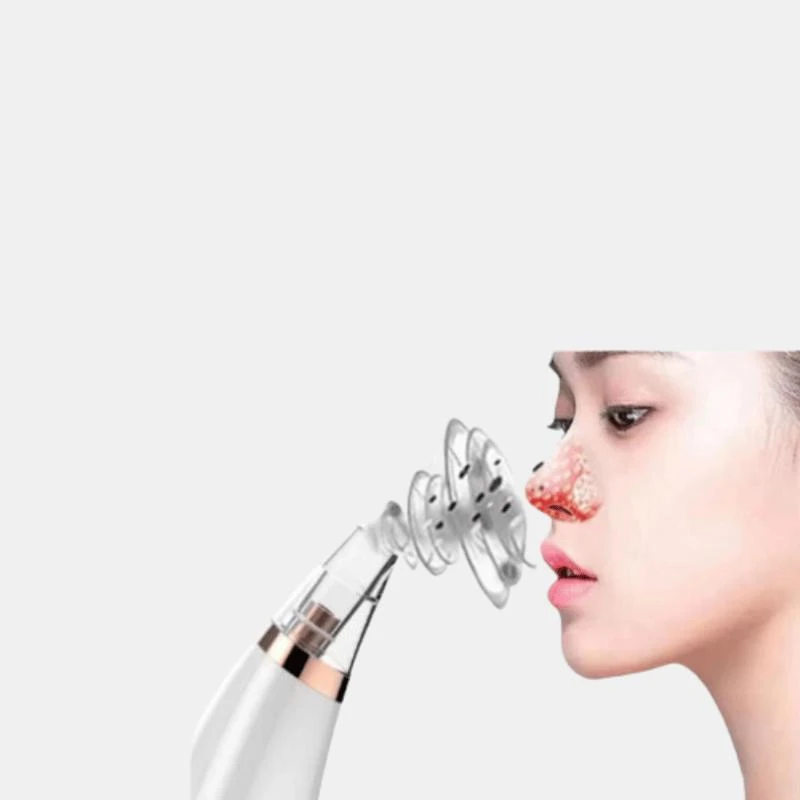 商品Vigor|Face, Facial Massager For Applicator, Reduce Puffiness & Pimples Deep Cleaning Tool Blackhead Remover Combo 1 COMBO PACK,价格¥300,第1张图片
