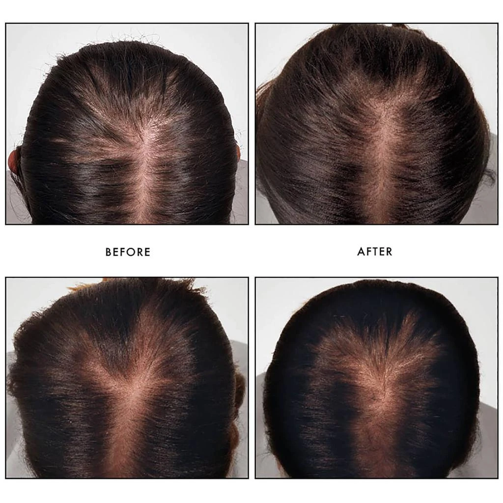 商品René Furterer|René Furterer Triphasic Reactional Concentrated Serum,价格¥616,第2张图片详细描述