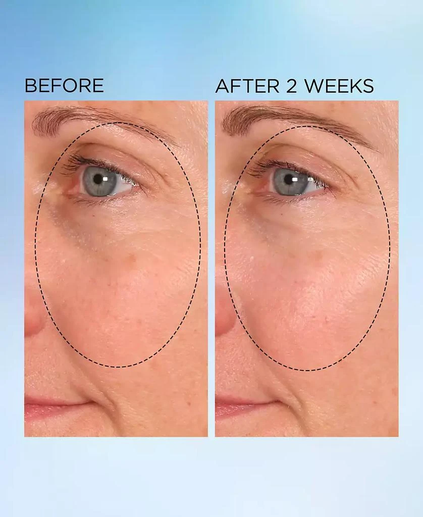 Visible Brightening Clearly Radiant Spot Correcting Capsules, 30 capsules 商品