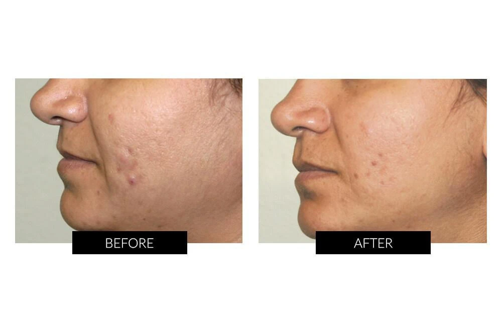 商品CurrentBody Skin|CurrentBody Skin Face & Neck Kit (worth 719).Hongmall,价格¥4635,第4张图片详细描述