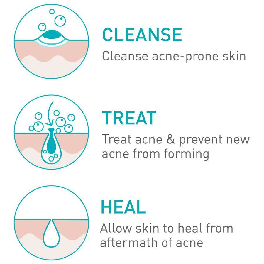 CeraVe Acne Foaming Cream Face Cleanser for Sensitive Skin 6