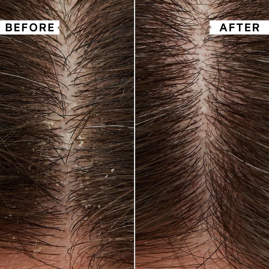 商品Philip Kingsley|Flaky Scalp Calming Toner,价格¥266,第2张图片详细描述