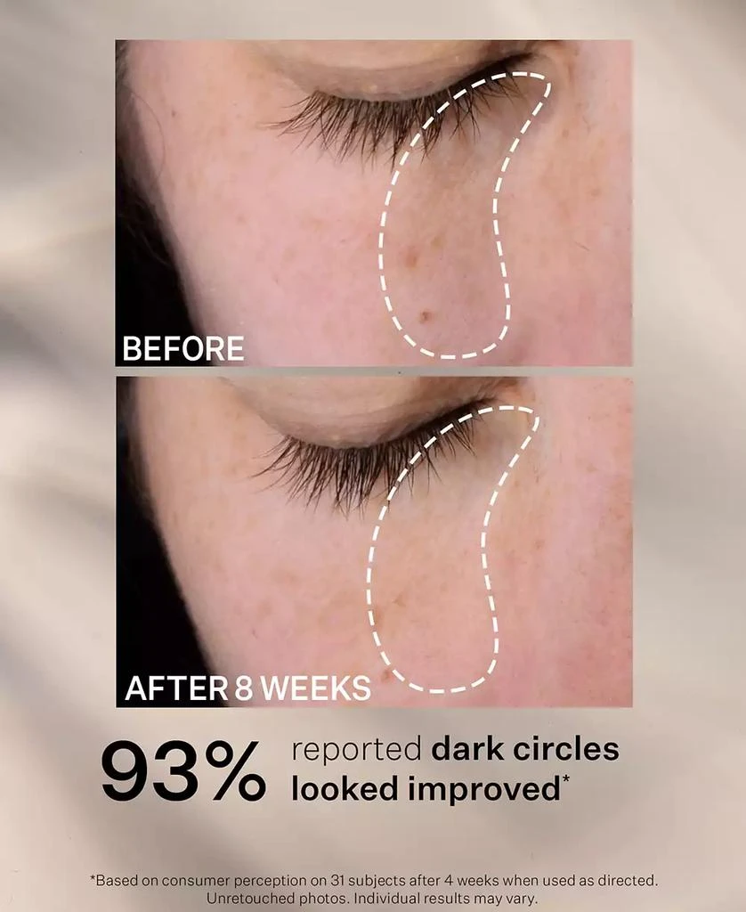 Super-C Dark Circle Brightening Eye Serum 商品