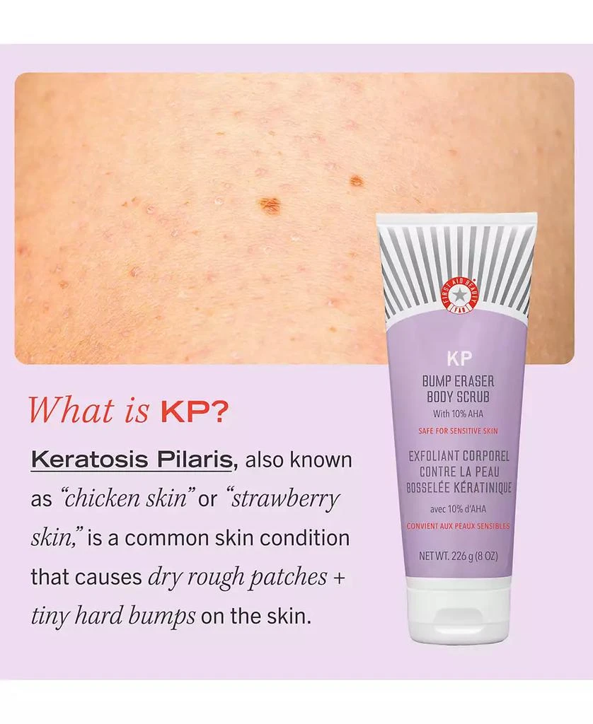 KP Bump Eraser Body Scrub with 10% AHA – Body Exfoliant for Keratosis Pilaris, 8.0 oz. 商品