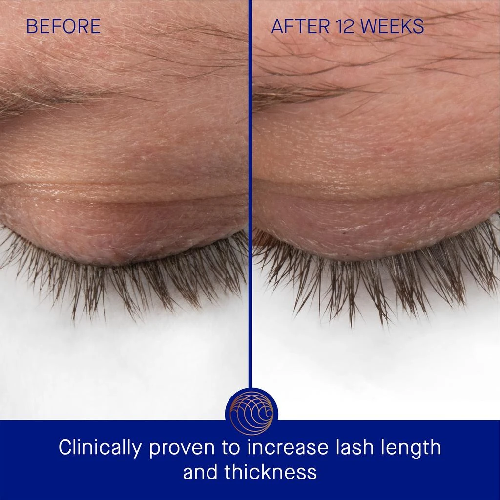 商品Augustinus Bader|Augustinus Bader The Eyebrow and Lash Enhancing Serum 8ml,价格¥1272,第3张图片详细描述