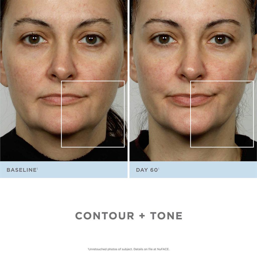 NuFACE Trinity Facial Toning Device商品第6张图片规格展示