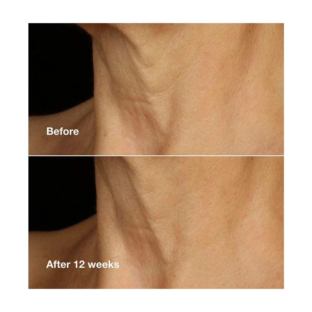 商品Clinique|Smart Clinical Repair Lifting Face + Neck Cream, 1.7 oz.,价格¥584,第4张图片详细描述