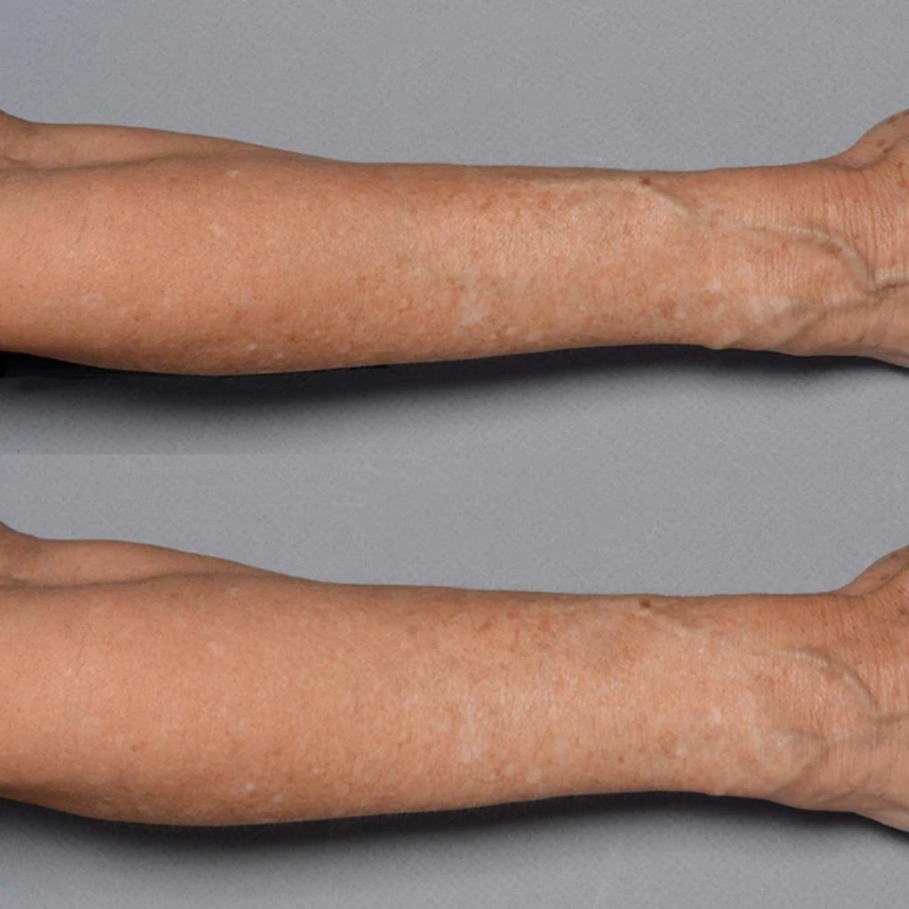 商品Perricone MD|Cold Plasma Plus+ Fragile Skin Therapy,价格¥411,第4张图片详细描述