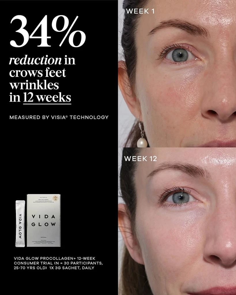 商品Vida Glow|Pro Collagen Plus, 30 x Sachets,价格¥542,第5张图片详细描述