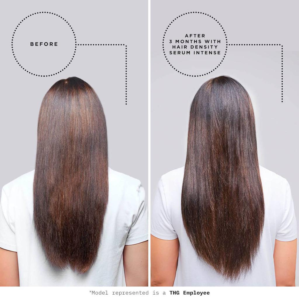 Supersize Hair Density Serum Intense Duo 2 x 90ml (Worth $132.00)(FREE MINI)商品第3张图片规格展示