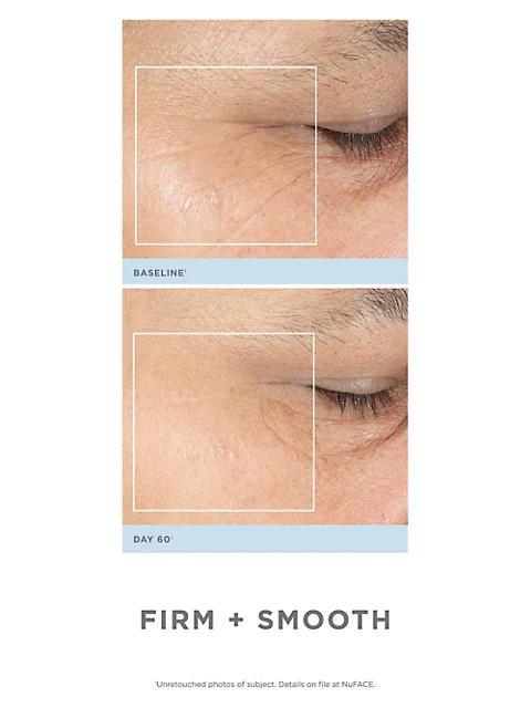 商品NuFace|Trinity® Precision Facial Toning Kit With Effective Lip & Eye Attachment,价格¥3282,第5张图片详细描述