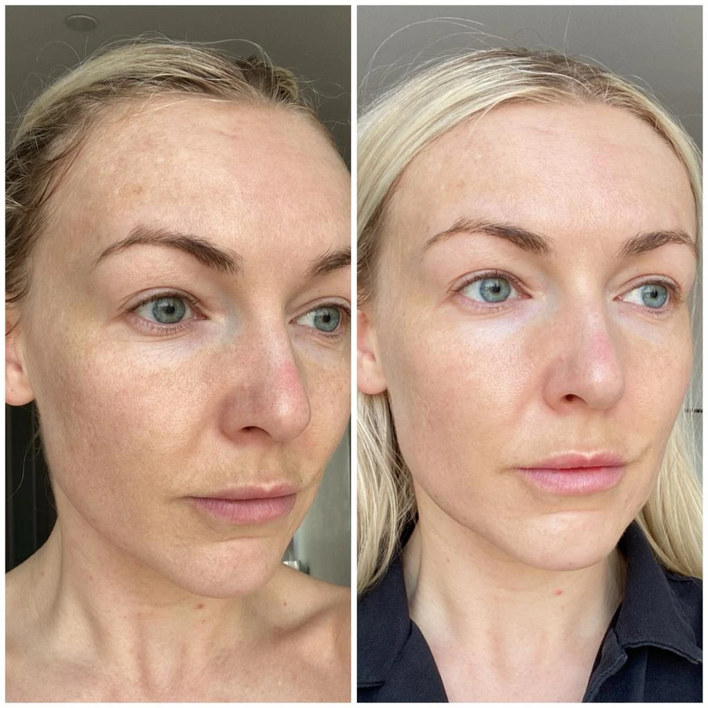 商品Ameliorate|AMELIORATE Resurfacing Facial Toner,价格¥233,第2张图片详细描述