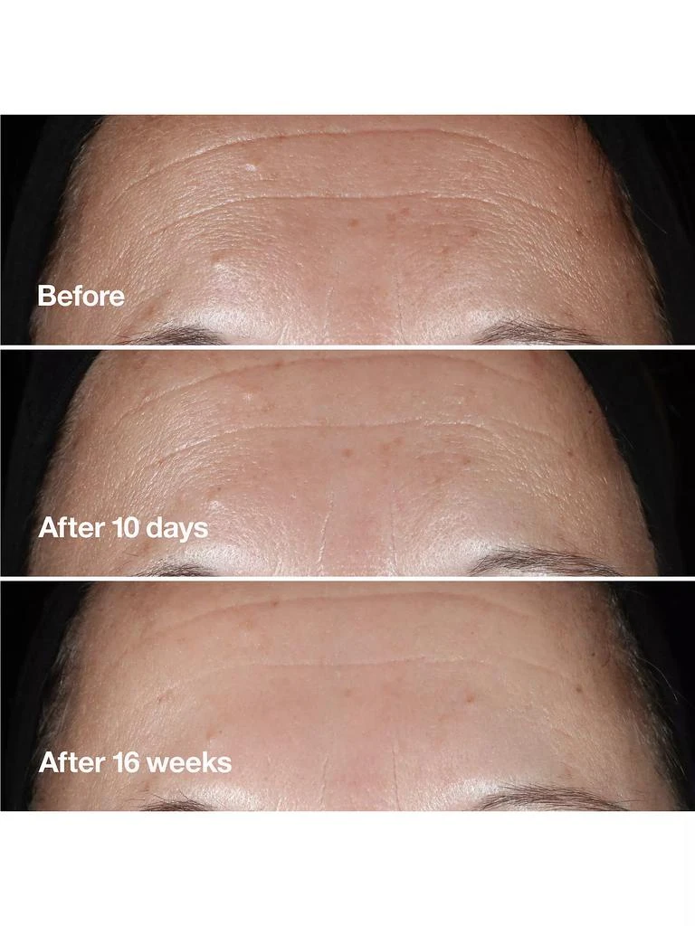 商品Clinique|Clinique Smart Clinical Repair Wrinkle Correcting Serum,价格¥1430,第3张图片详细描述