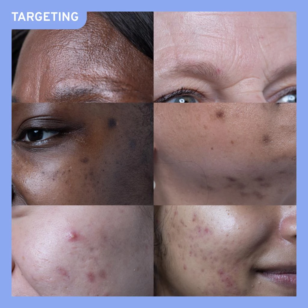 Retinoid 1 - Vitamin A Face Serum 商品